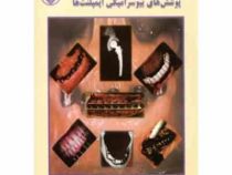 کاربرد پزشکی پوشش های بیوسرامیکی ایمپلنت ها (محمد حسن فتحی . وجیه السادات مرتضوی)